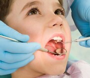 دندانپزشکی برای دانش‌آموزان رایگان شد + جزئیات