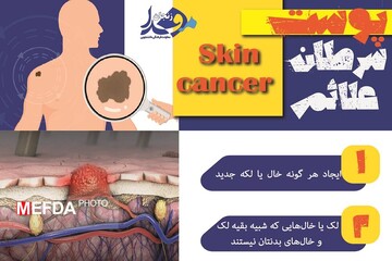 اگر این علائم  را دارید به سرطان پوست مبتلا شده اید! + عکس