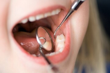خطرات پوسیدگی دندان برای سلامتی بدن