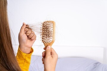 روشی ساده برای درمان ریزش مو