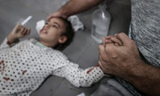 فاجعه در غزه؛ بیمارها با نور موبایل و بدون بیهوشی عمل می‌شوند