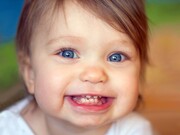 چگونه از پوسیدگی دندان در نوزادان جلوگیری کنیم؟
