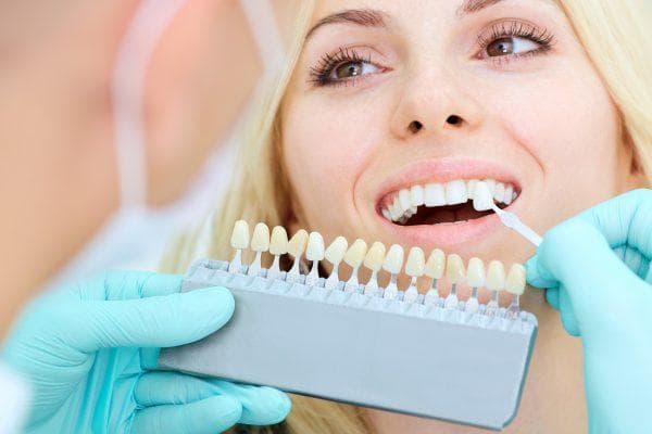 طول عمر و قیمت کامپوزیت دندان چقدر است + کامپوزیت دندان چیست