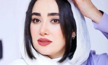 تغییرات چهره عجیب بهاره افشاری بازیگر مشهور سینما در ۴۰ سالگی + عکس
