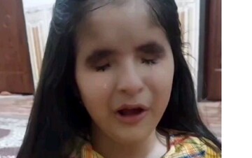 فیلم دردناک از زیباترین دختر ایران که نابیناست /  چرا خدا چشم های من را باز نمی کند