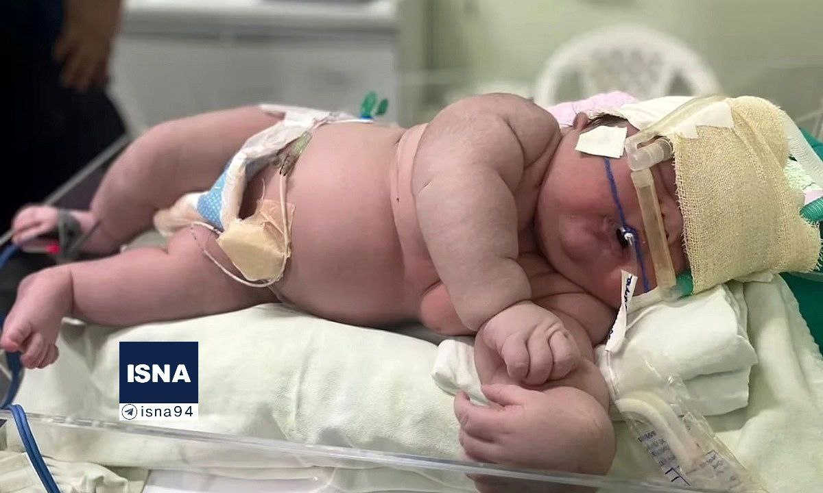 اتفاق بی سابقه در ایران / عجیب ترین نوزاد ایران به دنیا آمد + عکس