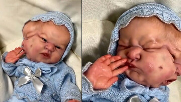 تولد نوزاد عجیب الخلقه که دو سر دارد! + فیلم باور نکردنی