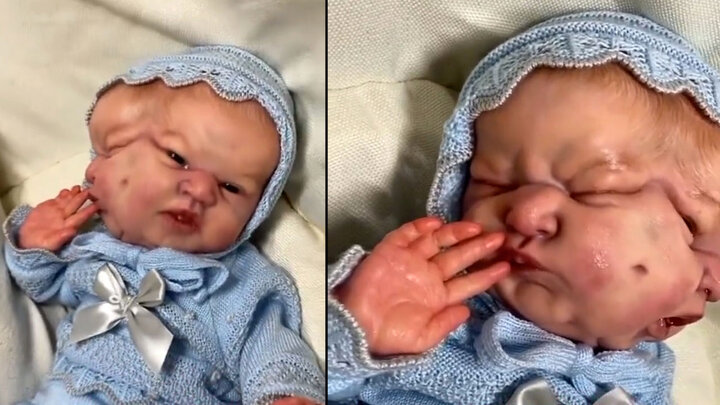 تولد نوزاد عجیب الخلقه که دو سر دارد! + فیلم باور نکردنی