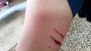 حمله وحشیانه سگ ولگرد به یک دانش آموز در پرند / عکس