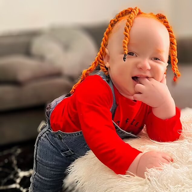 تولد نوزادی عجیب از پدر و مادری سیاه پوست