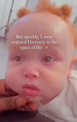 تولد نوزادی عجیب از پدر و مادری سیاه پوست