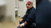 حمله به یک مسئول ایرانی با چاقو و قمه + عکس