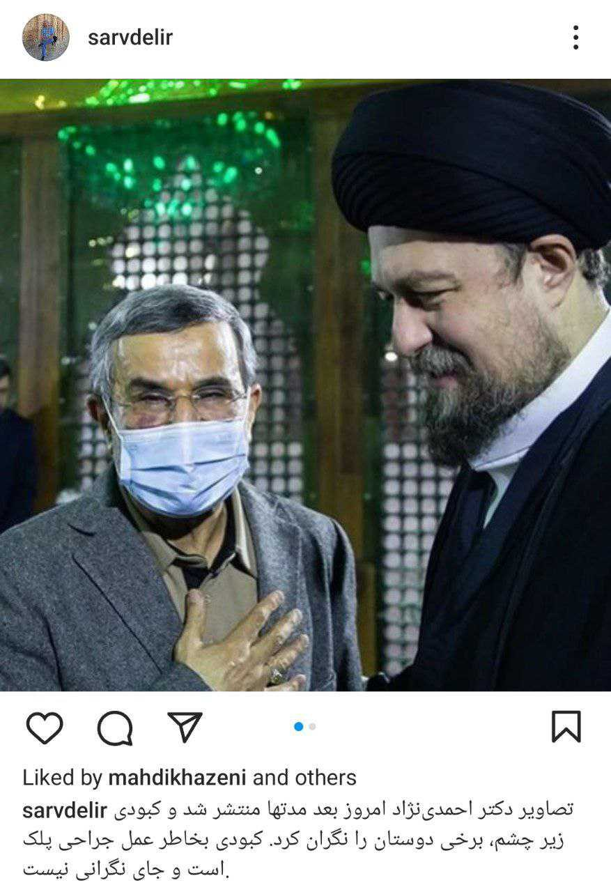 تغییر چهره محمود احمدی نژاد بعد از عمل زیبایی جدیدش + عکس