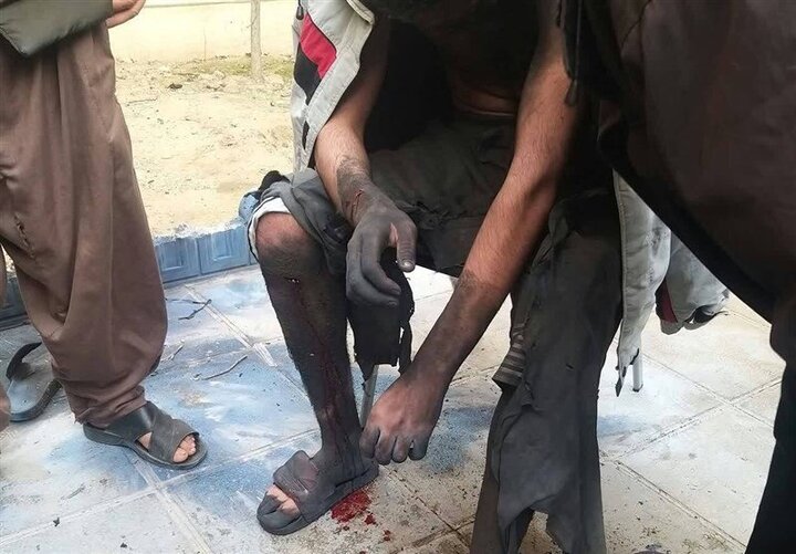 اولین حادثه چهارشنبه سوری در تهران / انفجار مواد محترقه در دست یک نوجوان
