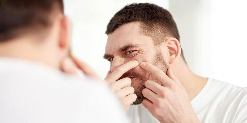 استفاده از خمیردندان برای از بین بردن جوش صورت موثر است؟ | مضرات خمیر دندان برای پوست