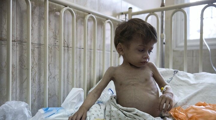 شهادت ۷ کودک فلسطینی در اثر گرسنگی