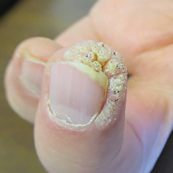 انتقال یک بیماری خطرناک در آرایشگاههای زنانه