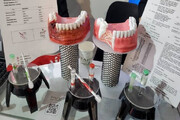ترمیم استخوان‌ها با نانوذرات / امیدی برای درمان‌های ارتوپدی و دندان‌پزشکی