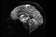 رونمایی از نخستین تصاویر مغزی ثبت‌شده توسط قوی‌ترین دستگاه MRI جهان / قدرتی فراتر از تصور