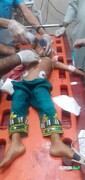 عکس تلخ از کودک بلوچ در حادثه دیشب چابهار