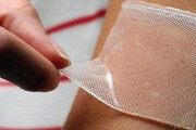 جدیدترین پانسمان برای زخم‌های دیابتی