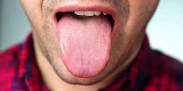 تلخی دهان نشانه چه بیماری است؟