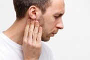 اگر روی لاله گوش خود مو دارید به این بیماری مبتلا شده اید