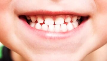 با مصرف این دارو مجدد دندان های شما رشد می کند! + کشف داروی معجزه گر برای رشد دندان های افتاده