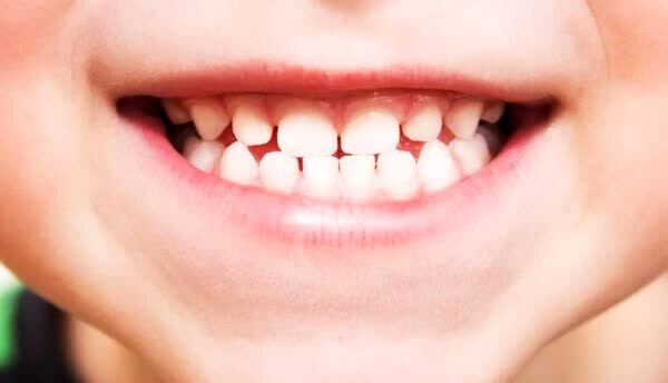 با مصرف این دارو مجدد دندان های شما رشد می کند! + کشف داروی معجزه گر برای رشد دندان های افتاده