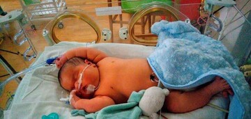 تولد یک نوزاد سنگین وزن در میاندوآب + عکس