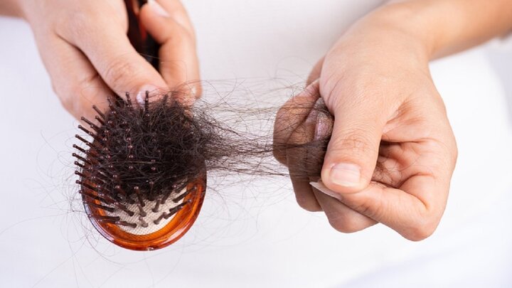 دلیل اصلی ریزش موی سر در خانم ها چیست؟