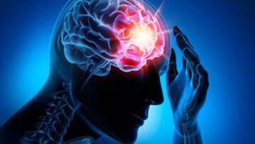 افزایش بیماری‌های مغز و اعصاب / روزانه ۵۰۰ نفر دچار سکته مغزی می‌شوند