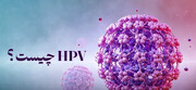 بیماری HPV چیست؟ + حقایق جالب