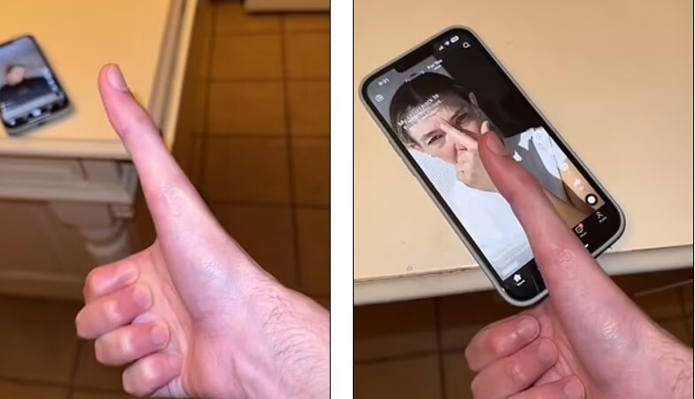 این مردی صاحب بزرگترین انگشت شَست دنیا است! + عکس