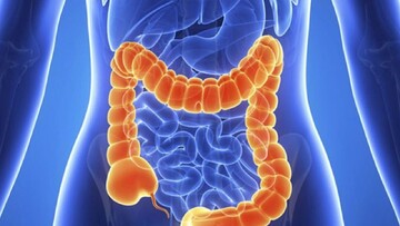 بهترین درمان التهاب روده