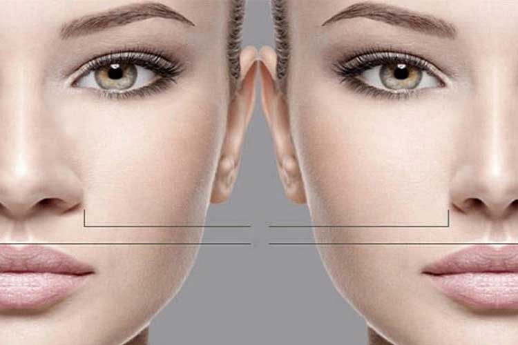 بهترین جراح بینی بدون بیهوشی