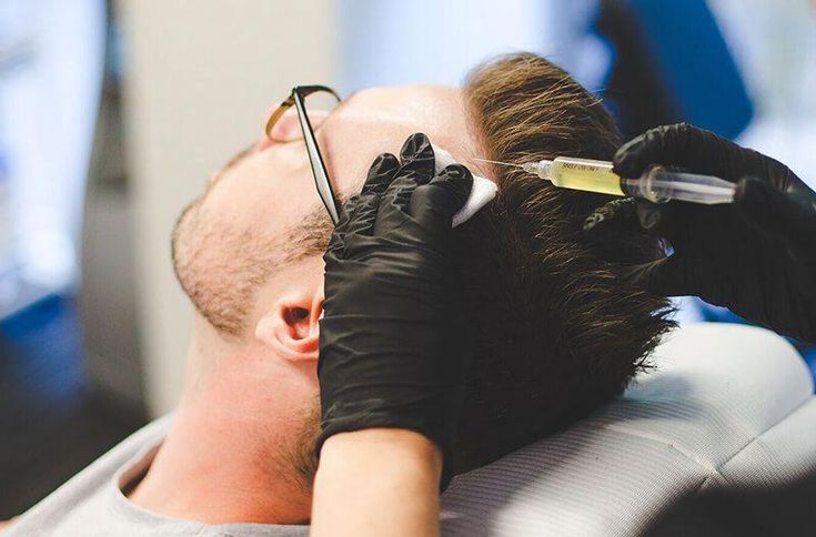 مقایسه کاشت مو با داروهای ضد ریزش مو: کدام یک مؤثرتر است؟