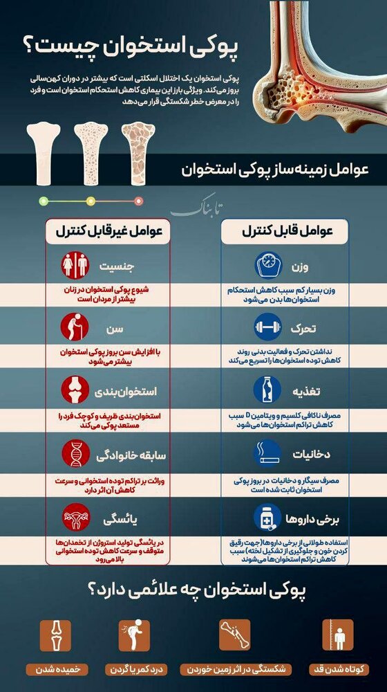 علائم پوکی استخوان که از آن بی اطلاعید! + عکس