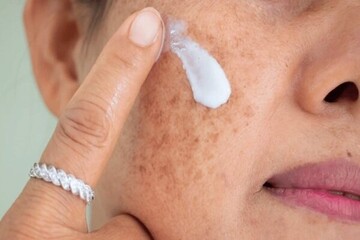 یک دلیل مشخص برای خشکی پوست