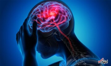 رابطه روش‌های جلوگیری از بارداری و سکته مغزی چیست؟