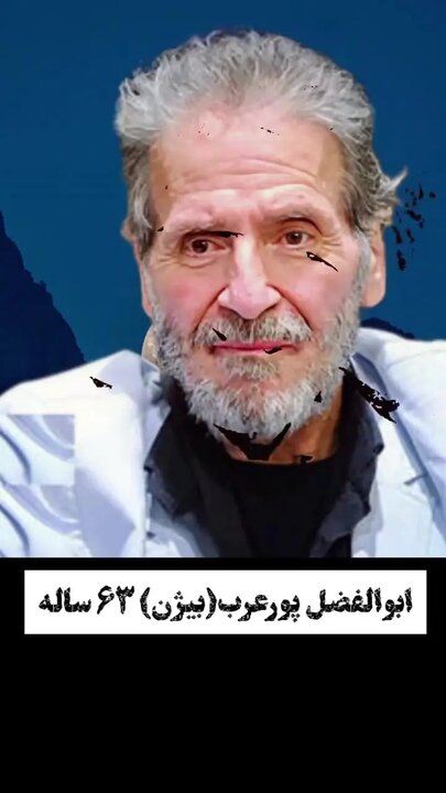 تغییر چهره جالب بازیگران «وضعیت سفید» + فیلم