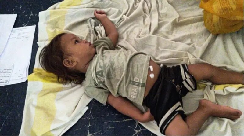 نوزاد هندی با دندانهایش مار کبرا را کُشت و خود را نجات داد + عکس