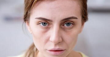 اگر این علائم را دارید به کم خونی دچار شده اید!