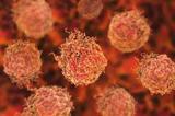 آزمایشی سریع و ارزان برای تشخیص متاستاز سرطان پروستات