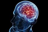 از دست رفتن نورون‌ها عامل اصلی سکته مغزی
