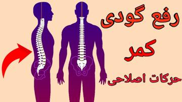 حرکات اصلاحی برای درمان گودی کمر