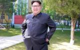 ناکامی پزشکان در عمل جراحی مغز «کیم جونگ اون»/ مغز رهبر کره شمالی از کار افتاد؟