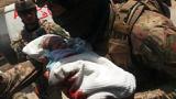 تصاویری دردناک از  نوزادان افغانی که گلوله باران شدند