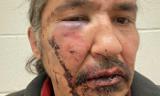 واکنش ترودو  به رفتار پلیس با رییس بومیان کانادا