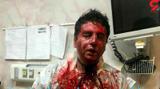 ضرب وشتم متخصص بی هوشی بیمارستان پیرانشهر با چاقو + عکس